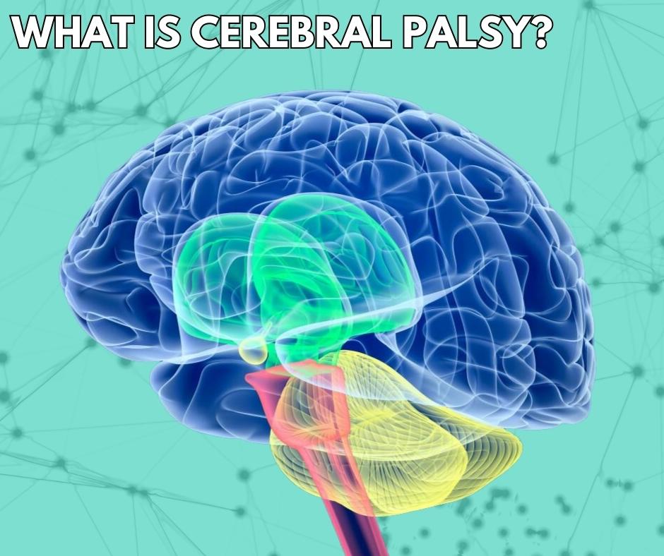 Cerebral Palsy treatment in India
