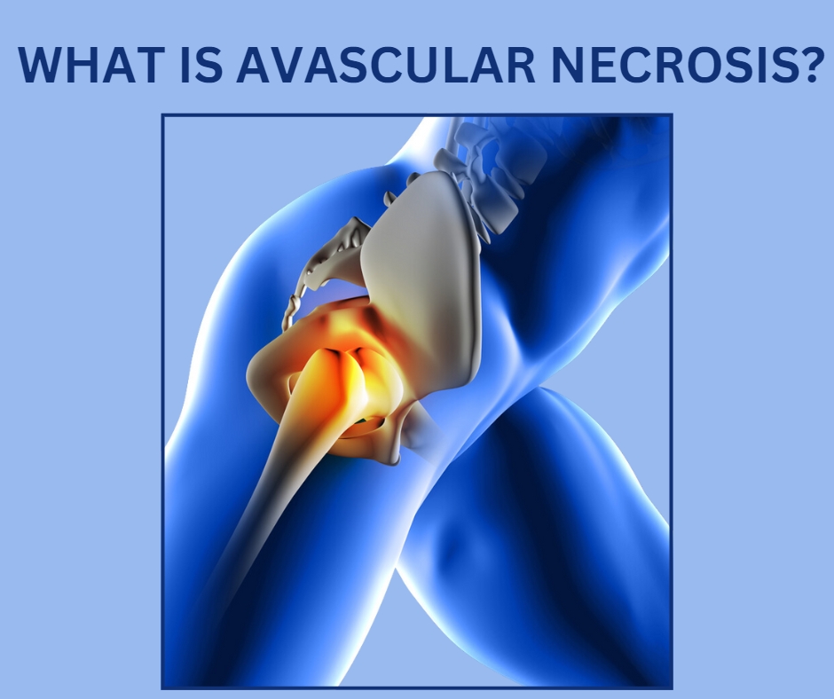 avascular necrosis treatment