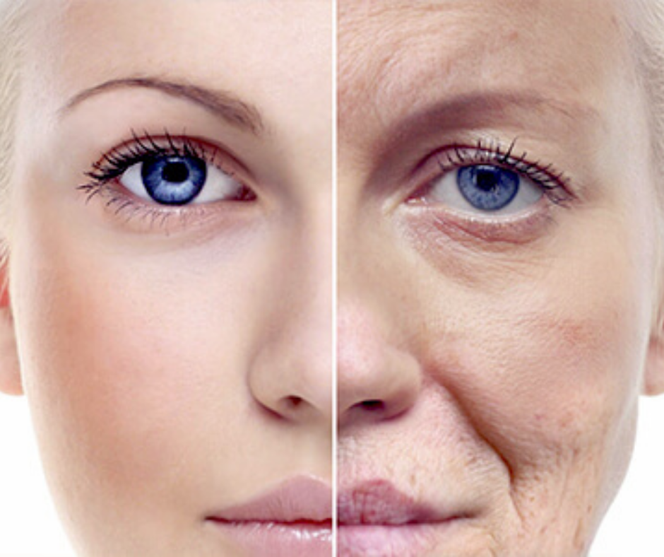 Effective anti-wrinkle treatments