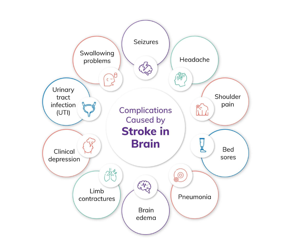what is brain stroke symptoms