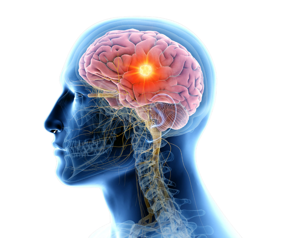 traumatic brain injury treatment