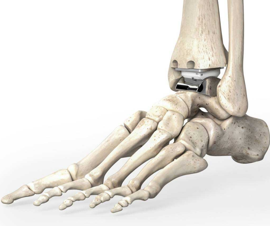 The Ankle Joint